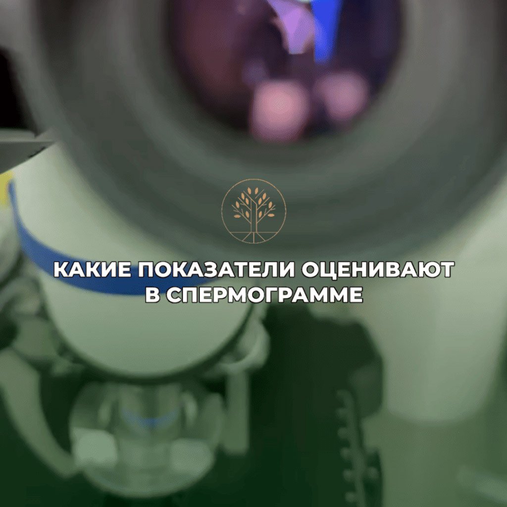Что оценивают в спермограмме