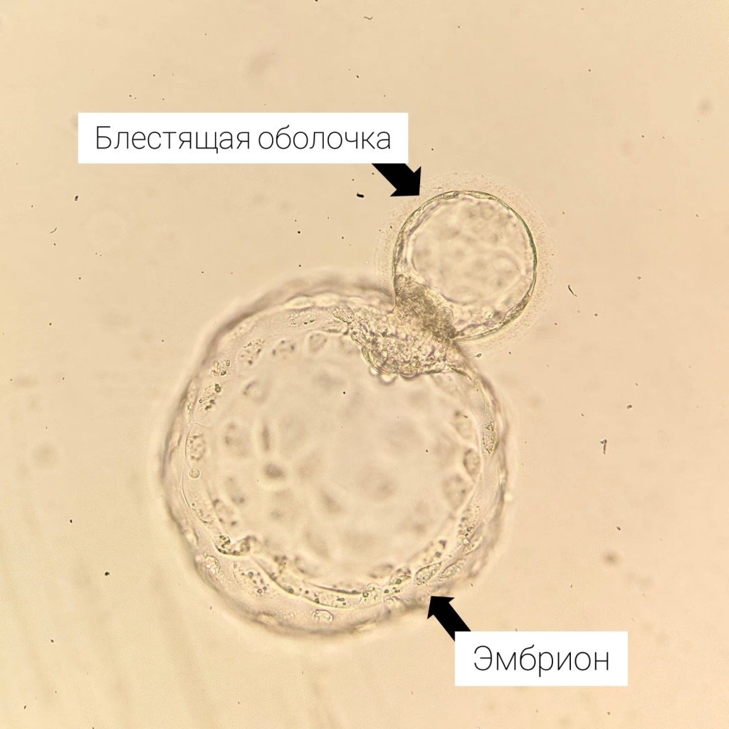 e5bc486196e5310762c97dea543fc507b2641a9f34521b340dd2337f337694a2.jpg
