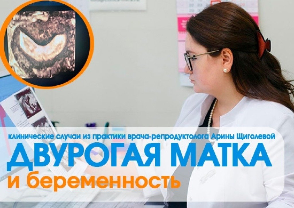 Перенос эмбрионов при двурогой матке