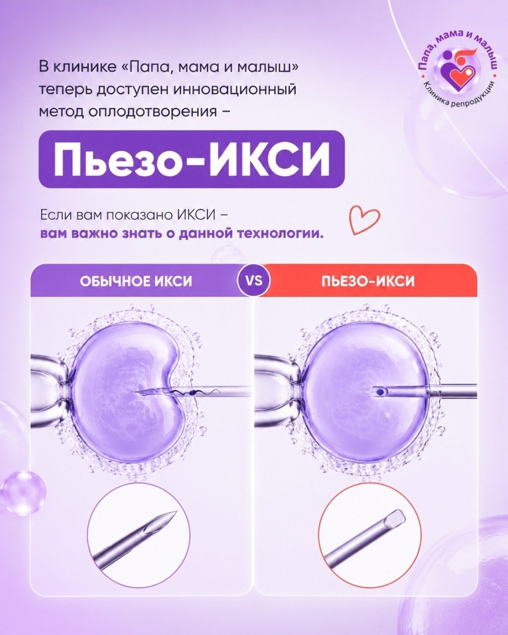 ЧТО ТАКОЕ ПЬЕЗО-ИКСИ?