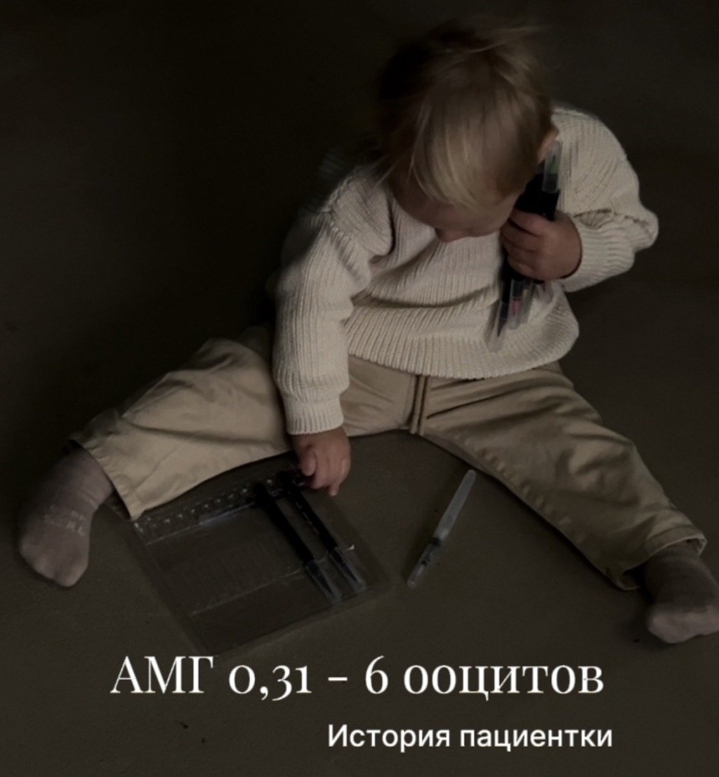 АМГ 0,31 - 6 ооцитов