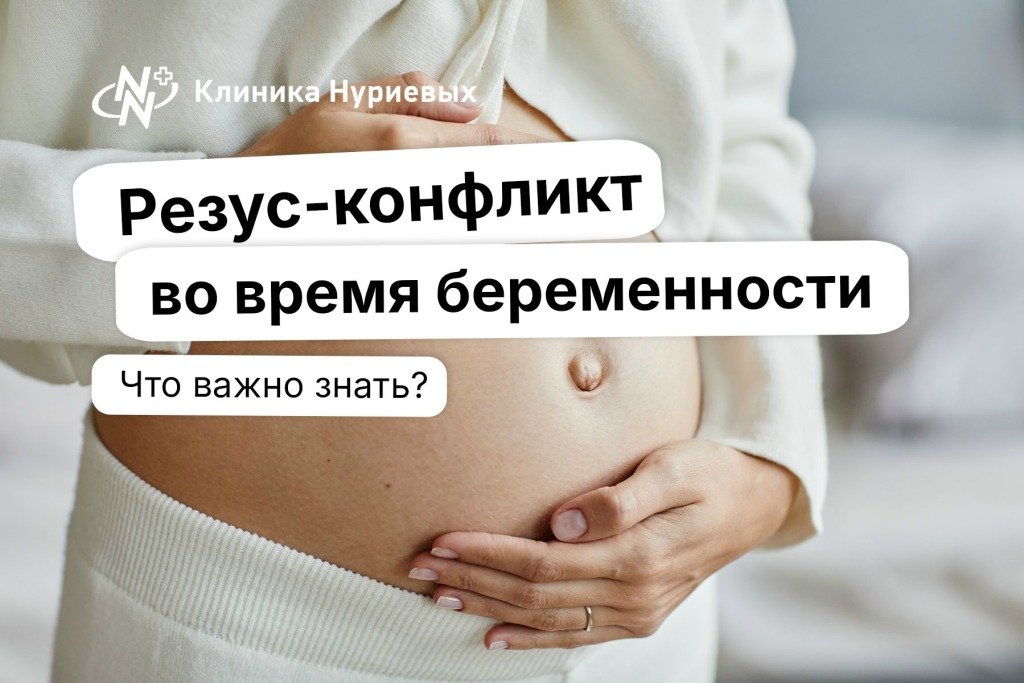 Резус-конфликт во время беременности: что важно знать?